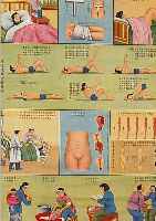 VIER BüCHER, CHINA, UM 1912, MIT INSGES. 16 ABSCHNITTEN üBER CHIRURGIE, ILLUSTRIERT, GEBRäUNT, FADENHEFTUNG, CA. 20 X 13 CM, DAZU ZWEI ...