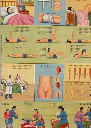 VIER BüCHER, CHINA, UM 1912, MIT INSGES. 16 ABSCHNITTEN üBER CHIRURGIE, ILLUSTRIERT, GEBRäUNT, FADENHEFTUNG, CA. 20 X 13 CM, DAZU ZWEI ...