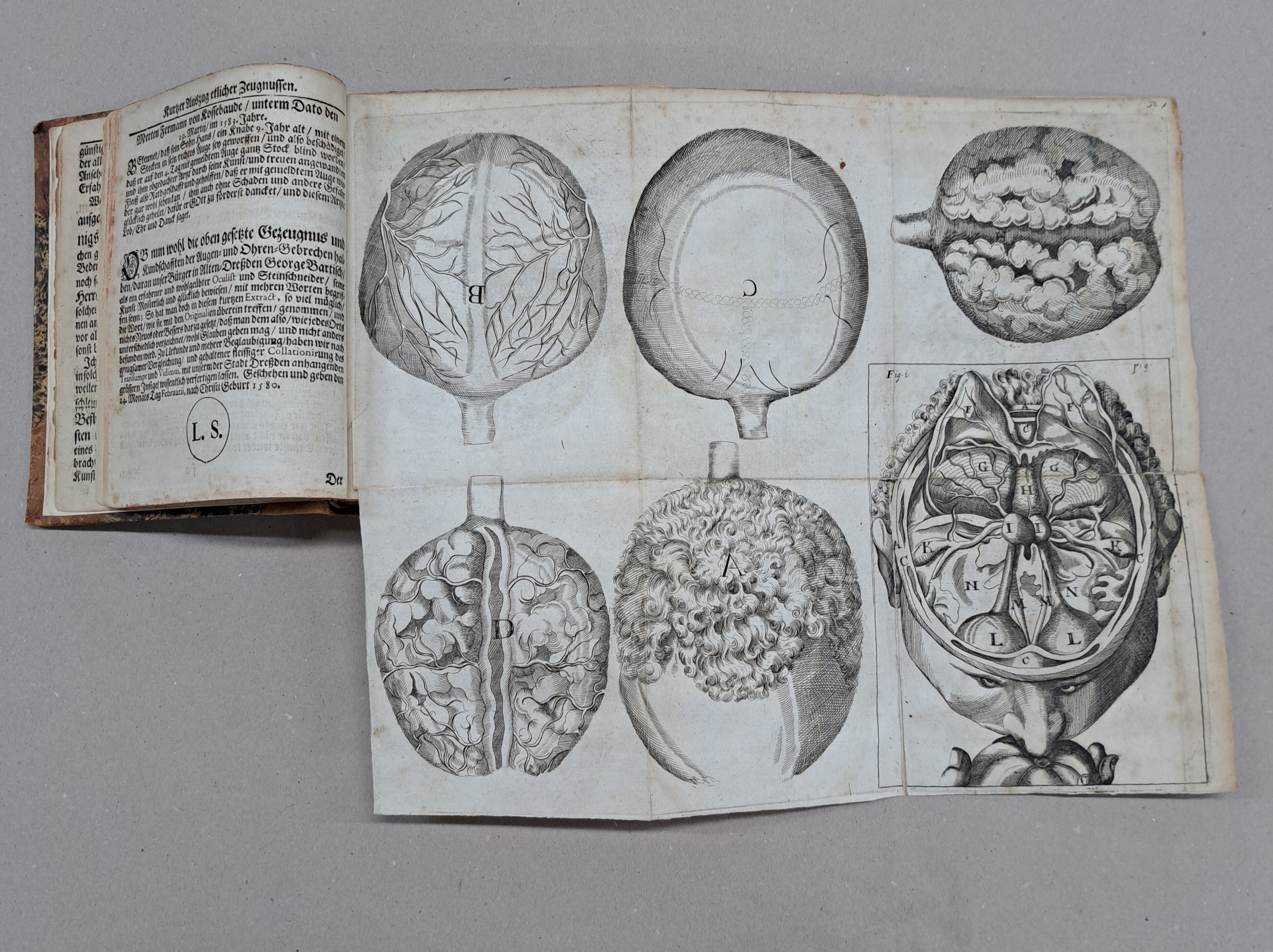 Detail a: Ophtalmologie: Georg Bartisch (1535-1607): Augen-Dienst. Bericht von allen und jeden in- und äusserlichen Mängelns, Schäden, Gebrechen und ...