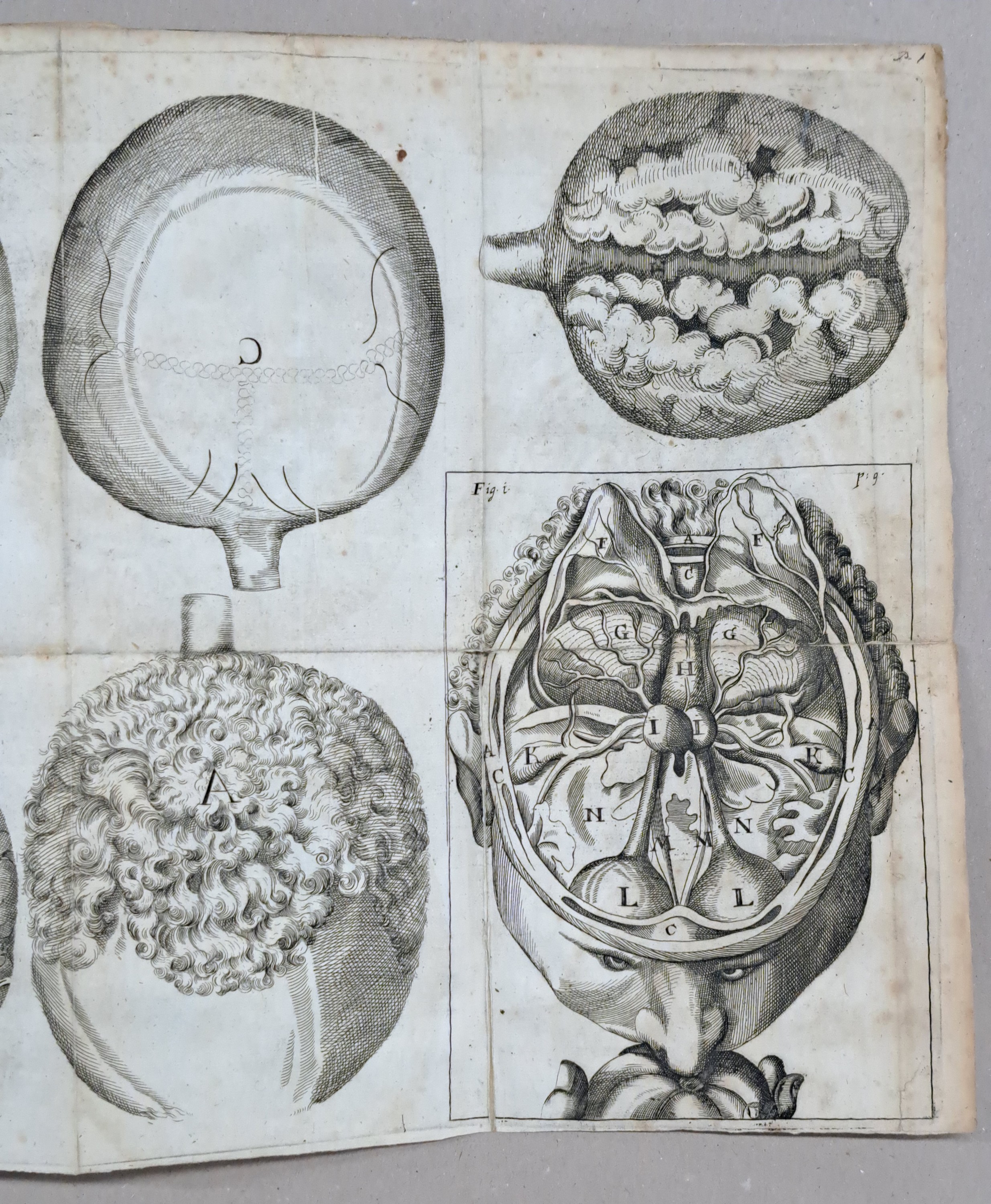 Detail b: Ophtalmologie: Georg Bartisch (1535-1607): Augen-Dienst. Bericht von allen und jeden in- und äusserlichen Mängelns, Schäden, Gebrechen und ...