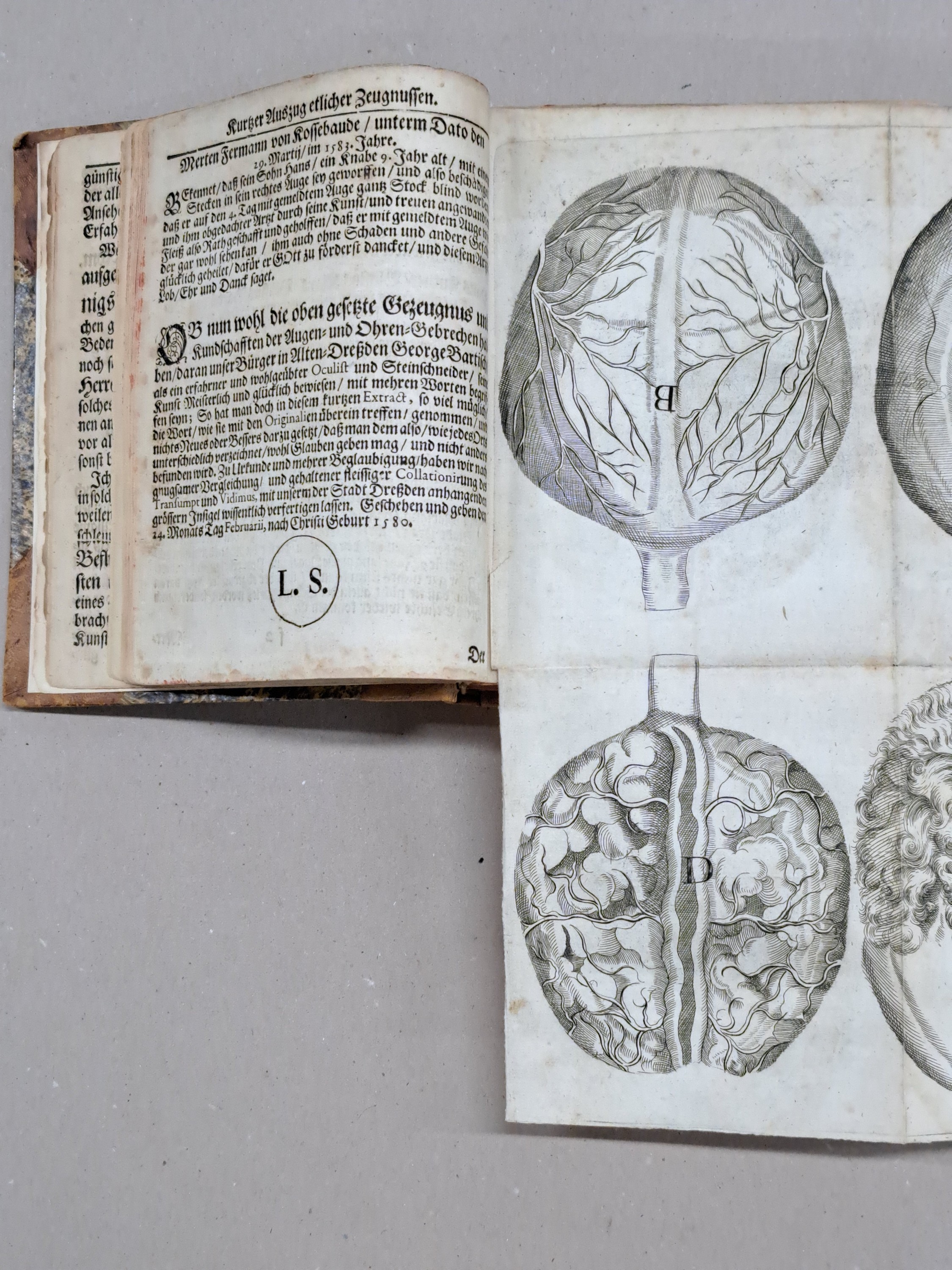 Detail c: Ophtalmologie: Georg Bartisch (1535-1607): Augen-Dienst. Bericht von allen und jeden in- und äusserlichen Mängelns, Schäden, Gebrechen und ...