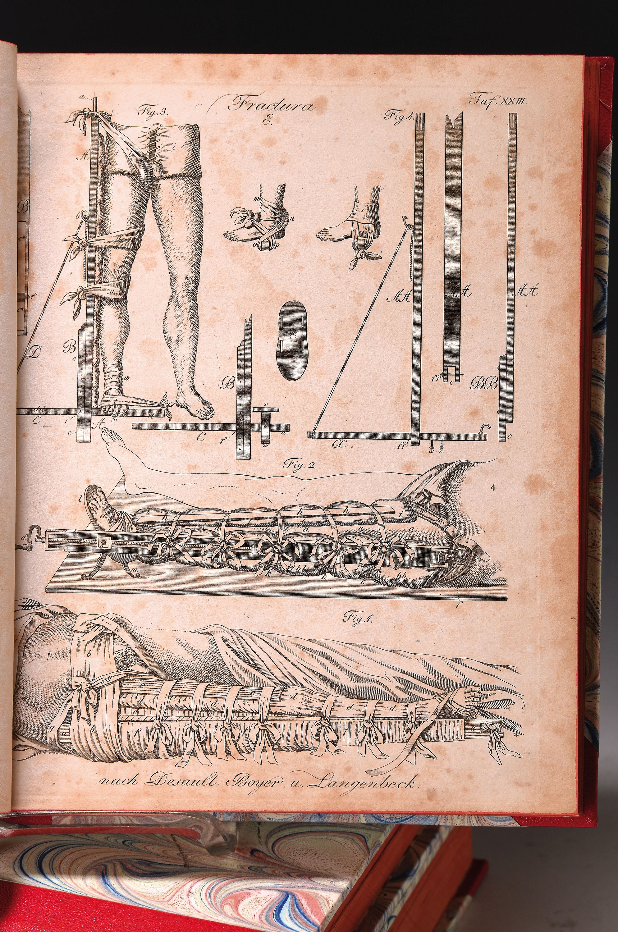 Ludwig Friedrich von Froriep (1779-1847): Chirugische Kupfertafeln. Eine auserlesene Sammlung der nöthigsten Abbildungen von äusserlich sichtbaren ...